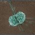 exosomes