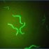 exosomes