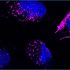 exosomes