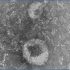 exosomes