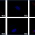 exosomes