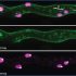 exosomes
