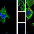 exosomes