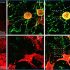 exosomes