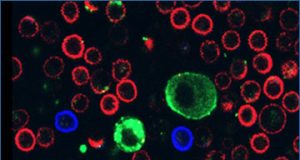 exosomes