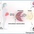 exosomes