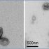 exosomes