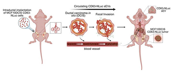 exosomes