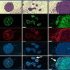 exosomes