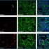 exosomes