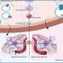 exosomes