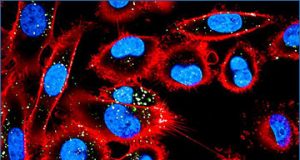 exosomes