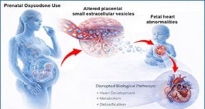 exosomes