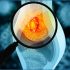 exosomes