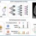 exosomes