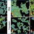 exosomes