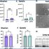 exosomes